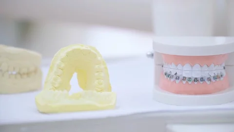Pan to teeth models Stock Footage 124399840