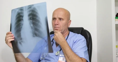 Pan View Medic Analyze Disease Evolution Lung Radiography Think Cure Method 스톡 동영상 83649076