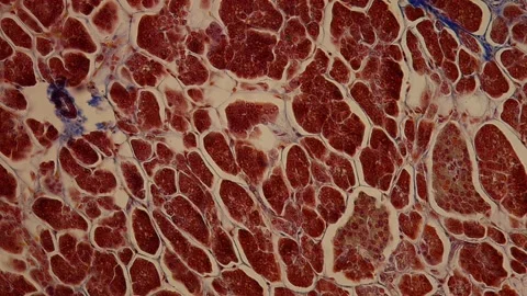Pancreas with islet cells in cross section Stock Footage 343960687