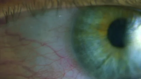 Panicking eye. Stock Footage 44562662
