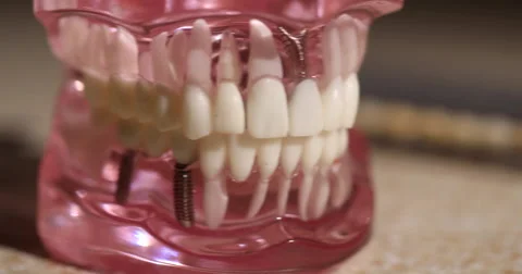 Panning on Model Teeth Right Stock Footage 62769221