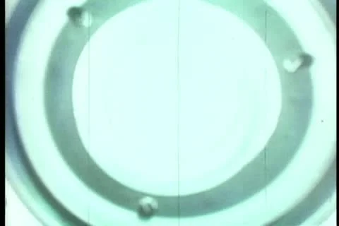 Panning operating room during surgery Stock-Footage 11366419