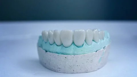 Panoramic close up view of dental implants in jaw with blue background. New Stock Footage 135972284