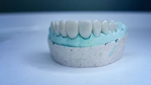 Panoramic close up view of dental implants in jaw with blue background. New Stock Footage 135972306