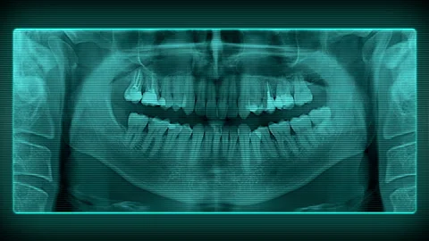 Panoramic dental X-ray Vidéo 95925426
