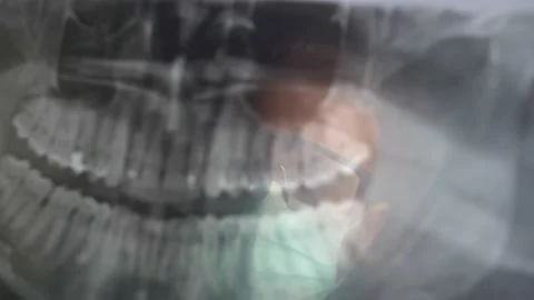 Panoramic Dental X-Ray Image Examined by Dentist in Surgical Mask and Glasses Stock Footage 147609476