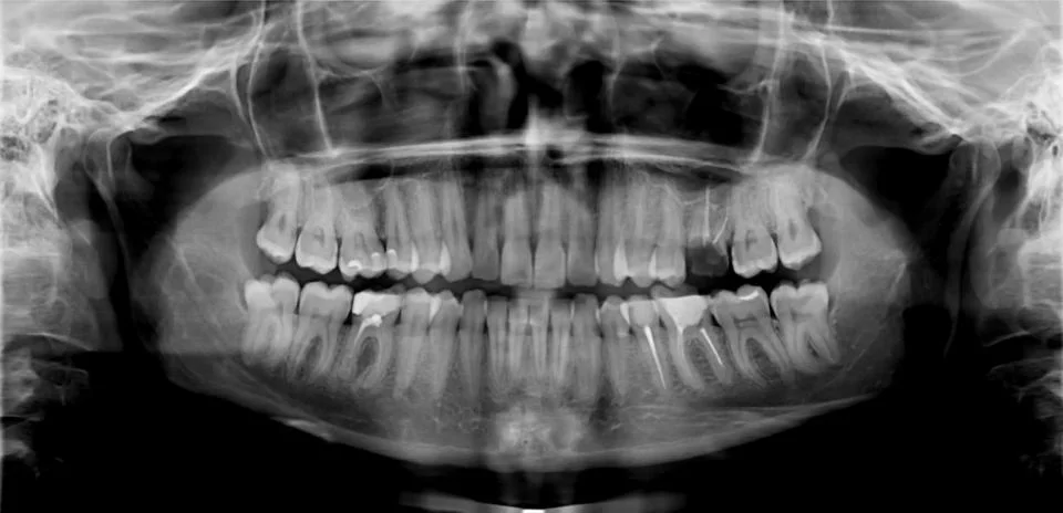 Panoramic tooth shot Stock Photos