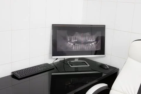 Panoramic x-ray on computer screen. Model of the jaw on the table Stock Photos