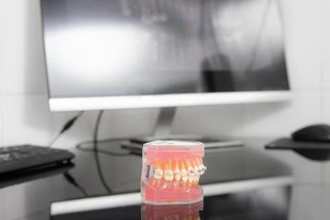 Panoramic x-ray on computer screen. Model of the jaw on the table Stock Photos