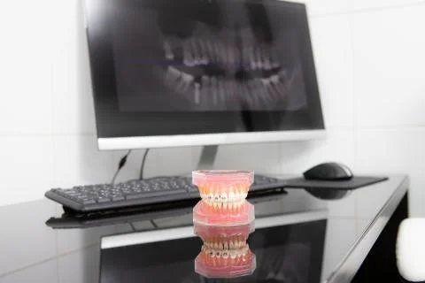 Panoramic x-ray on computer screen. Model of the jaw on the table Stock Photos