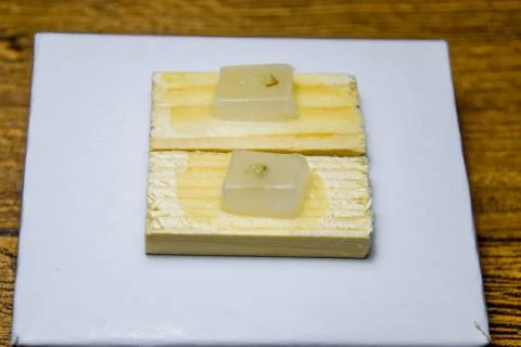 Paraffin blocks with cancer samples, samples for histological examination of  Foto stock