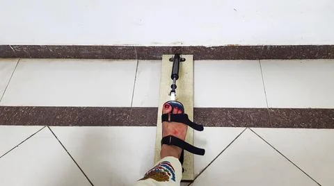 Paralyzed limb undergoing foot mobility training inside Foto stock