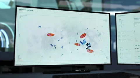 Paramecium Analysis By Microscope Software Interface For Microbiology Research Stock Footage 247130587