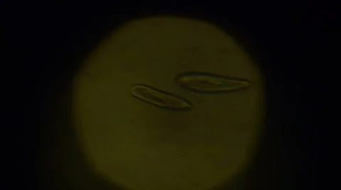 Paramecium Caudatum Stock-Footage 32722128