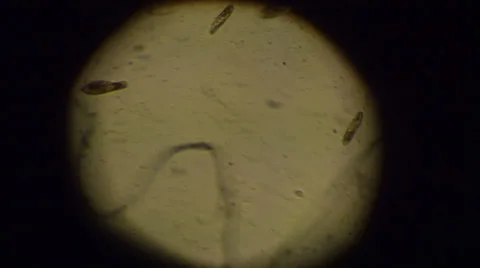 Paramecium Caudatum Stock-Footage 32722168