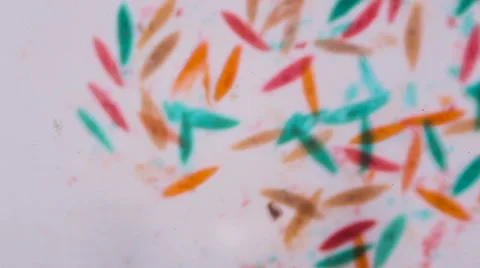 Paramecium caudatum under the microscope  Stock-Footage 62443502