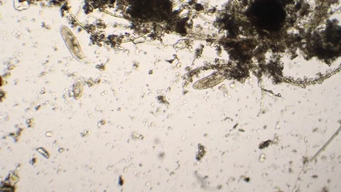 Paramecium caudatum under microscope Stock-Footage 87890350