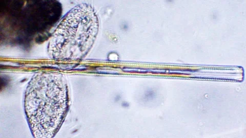 Paramecium is duplicating itself, time lapse Stock-Footage 276968514