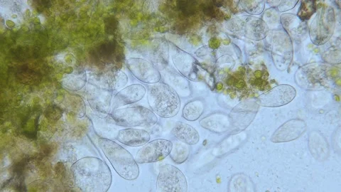Paramecium high density population in microscope bright filed Video stock 171867465