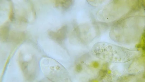 Paramecium high density population in microscope bright filed Video stock 171867615