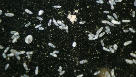 Paramecium high density population in microscope dark field Video stock 171867744
