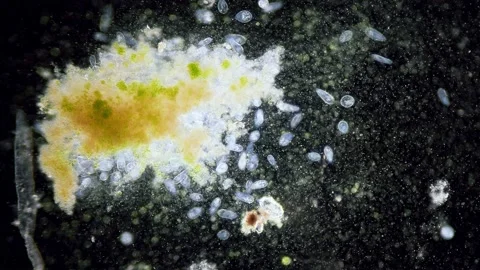 Paramecium high density population in microscope dark field Video stock 171867937