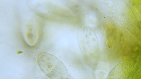 Paramecium high density population in microscope bright filed Video stock 171868222
