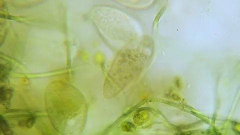 Paramecium high density population in microscope bright filed Video stock 171868352
