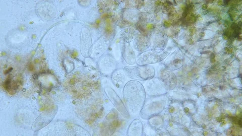 Paramecium high density population in microscope bright filed Video stock 171868785
