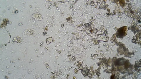 Paramecium at microscope Stock Footage 88972759
