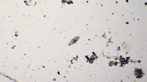 Paramecium motion at microscope Stock Footage 87816939
