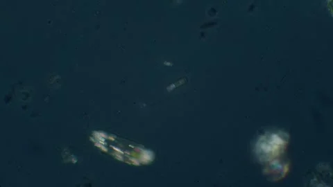 Paramecium in polarizing light Vídeos de archivo 322896833