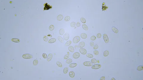 Paramecium single cell organisms in microscope bright field Stock Footage 144743219
