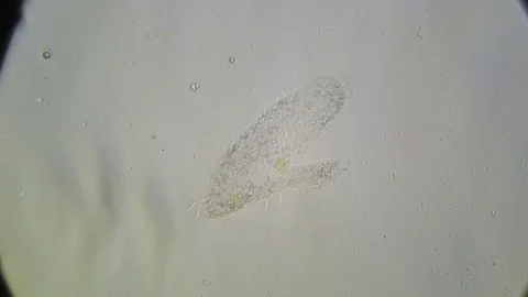 Paramecium with strange mutilation Stock Footage 81443879