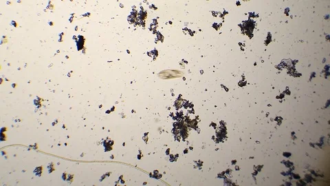 Paramecium swimming in pond water at mic... | Stock Video | Pond5