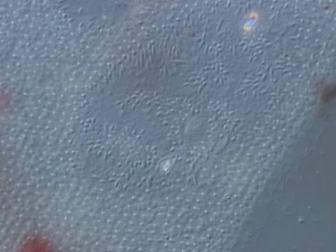 Paramecium, trichocysts Stock Footage 71373859