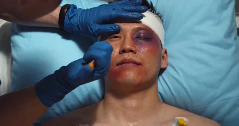 Paramedic checking up and using flashlight on injured young man Stock Footage 150215290