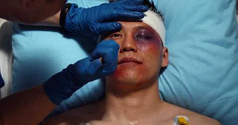 Paramedic checking up and using flashlight on injured young man Foto stock