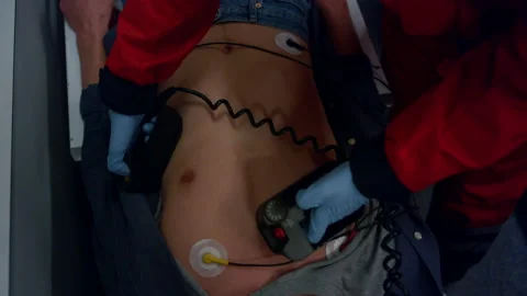 Paramedic hands using defibrillator. Doctor giving first aid help to man Stock Footage 166889173