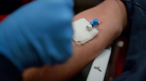 Paramedic inserting needle cannula in arm. Worker placing IV catheter into vein Foto stock