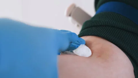 Paramedic performs blood draw carefully. Needle is inserted into forearm Video stock 337549122