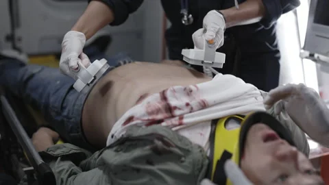 Paramedics using defibrillator for rescuing patient Video stock 164282734