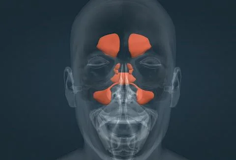 The paranasal sinuses are covered with a layer (mucosa) that is continuous wi Stock Illustration