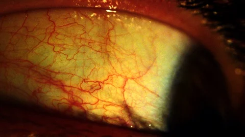 Paranoia eyeball looking around frantically 動画素材 129473258