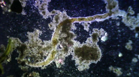 Parasite microscopic Stock Footage 60700446