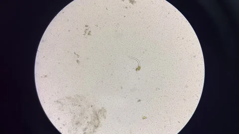 Parasite in stool examination test. Stock Footage 297524703