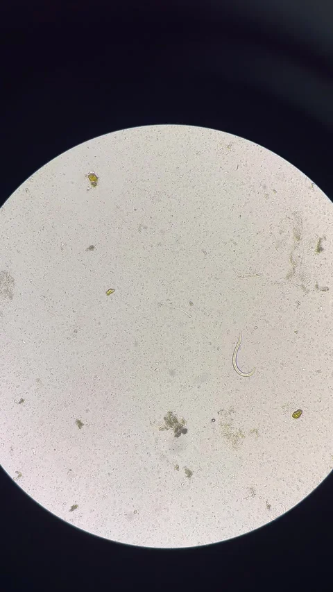 Parasite in stool examination test. Stock Footage 297524704