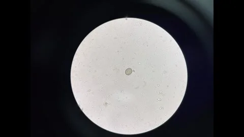 Parasite in stool examination test. Stock Footage 305979321