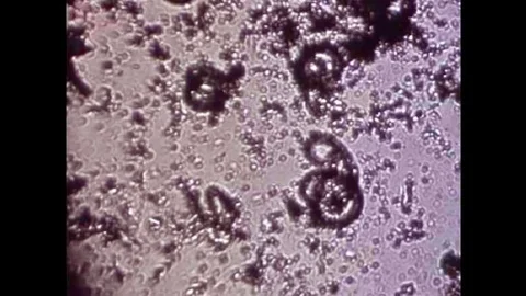 The parasite Trichonisis under a microscope in the 1940s Stock Footage 101200750