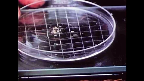 The parasite Trichonisis under a microscope in the 1940s Stock Footage 101200754